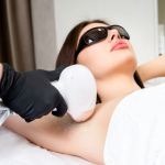 laser hair removal