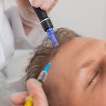 exosome for hair loss