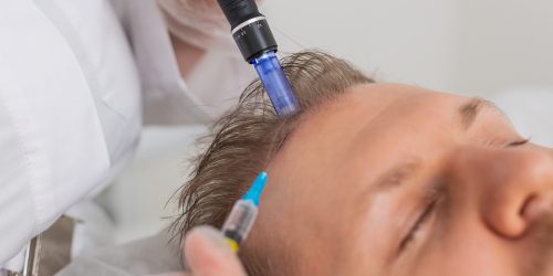 exosome for hair loss