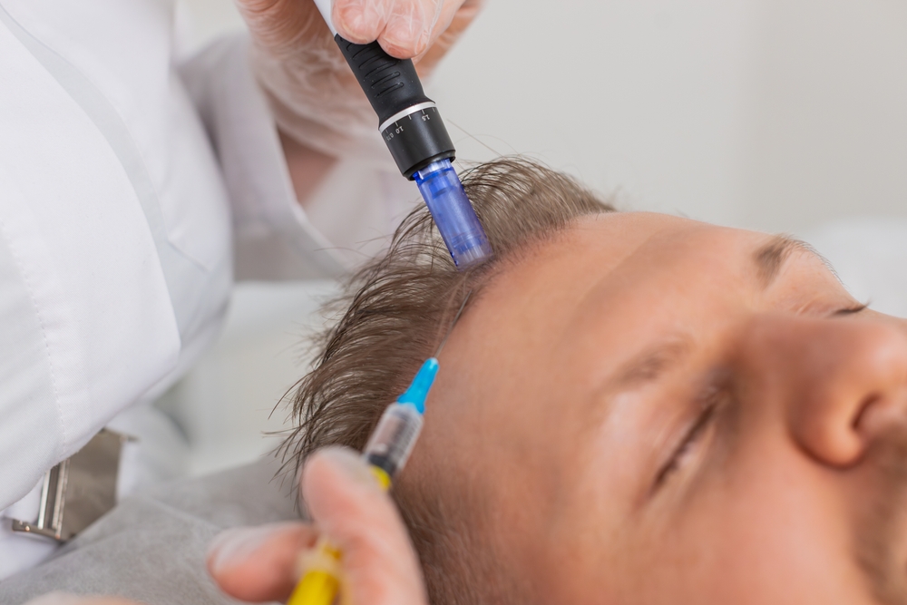 exosome for hair loss