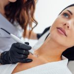 mole removal treatment