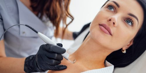 mole removal treatment