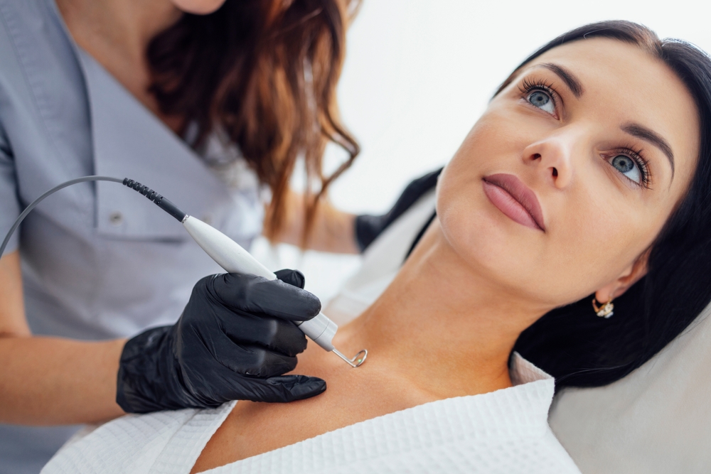 mole removal treatment