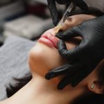 fillers treatment in lahore