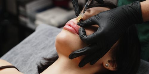 fillers treatment in lahore