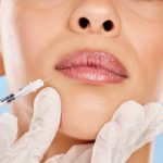 fillers treatment