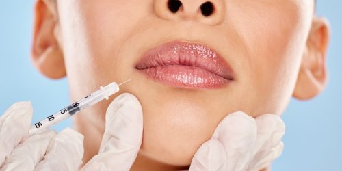fillers treatment