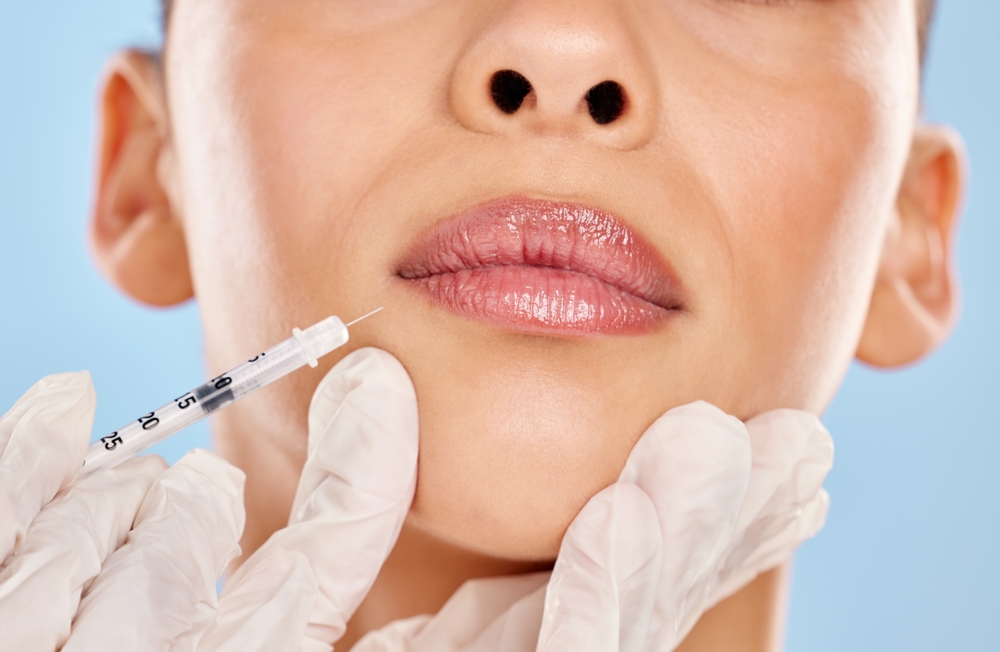 fillers treatment