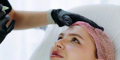 eosome treatment in lahore and faisalabad