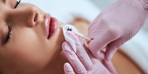 fillers treatment