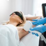 laser hair removal