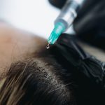 hair rejuvenation treatment
