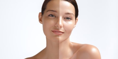 skin whitening treatment