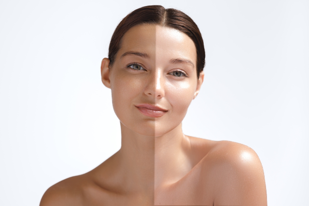 skin whitening treatment