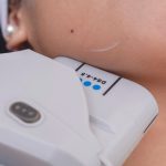 Hifu Treatment in lahore