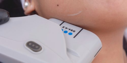 Hifu Treatment in lahore